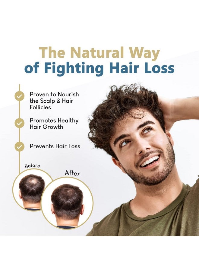 HAIRMETTO - ® Topical Hair Oil Hair Loss Product Formulated With Saw Palmetto Oil And Pumpkin Seed Oil For Hair Growth Soothes Dry Scalp Strengthens Roots Lavender Scent 118 Ml Bottle - Image 1