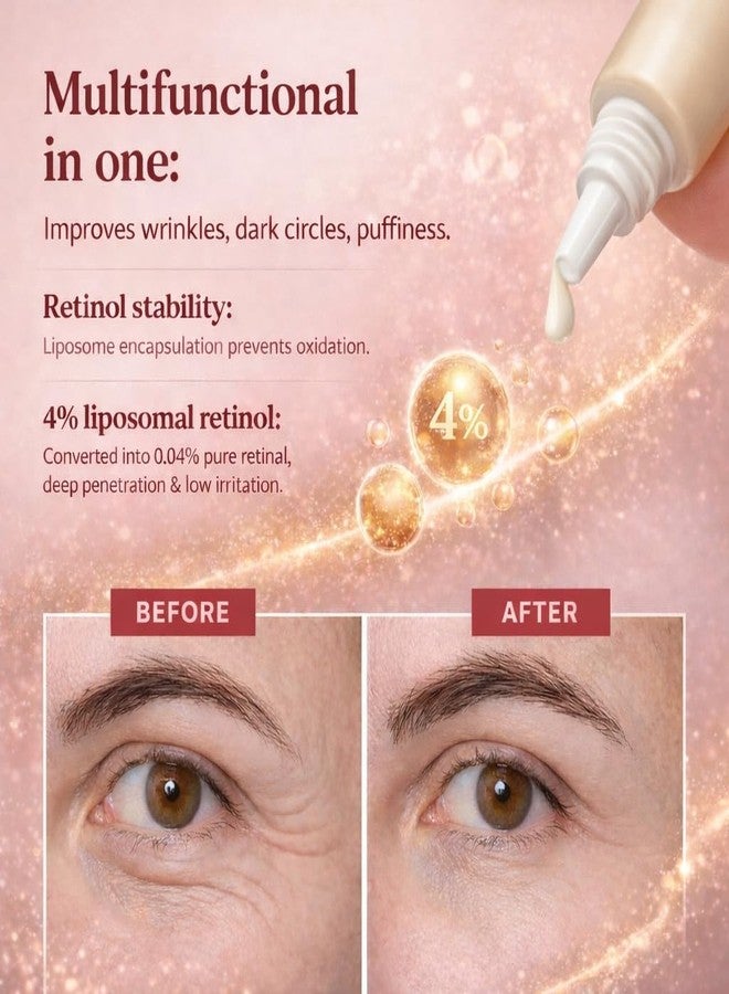 Mokleva SEOUL 1988 Eye Cream With Retinal Liposome 4% + Fermented Bean Complex, Anti-Aging Under Eye Cream For Dark Circle, Wrinkles, Fine Lines, Brightening, Firming, Hydrating Eye Care 30ml/1.01fl.oz - Image 2