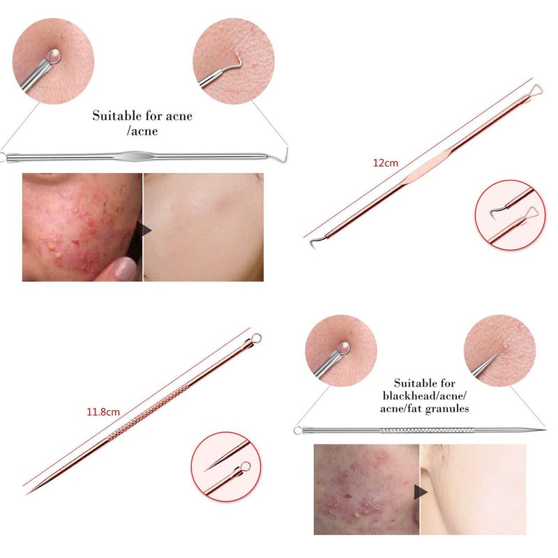 ZTRHYOO Blackhead Remover Pimple Comedone Extractor Tool Best Acne Removal Kit - Treatment for Blemish, Whitehead Popping, Zit Removing for Risk Free Nose Face Skin with Case(Rose, 4 Piece Set) - Image 5