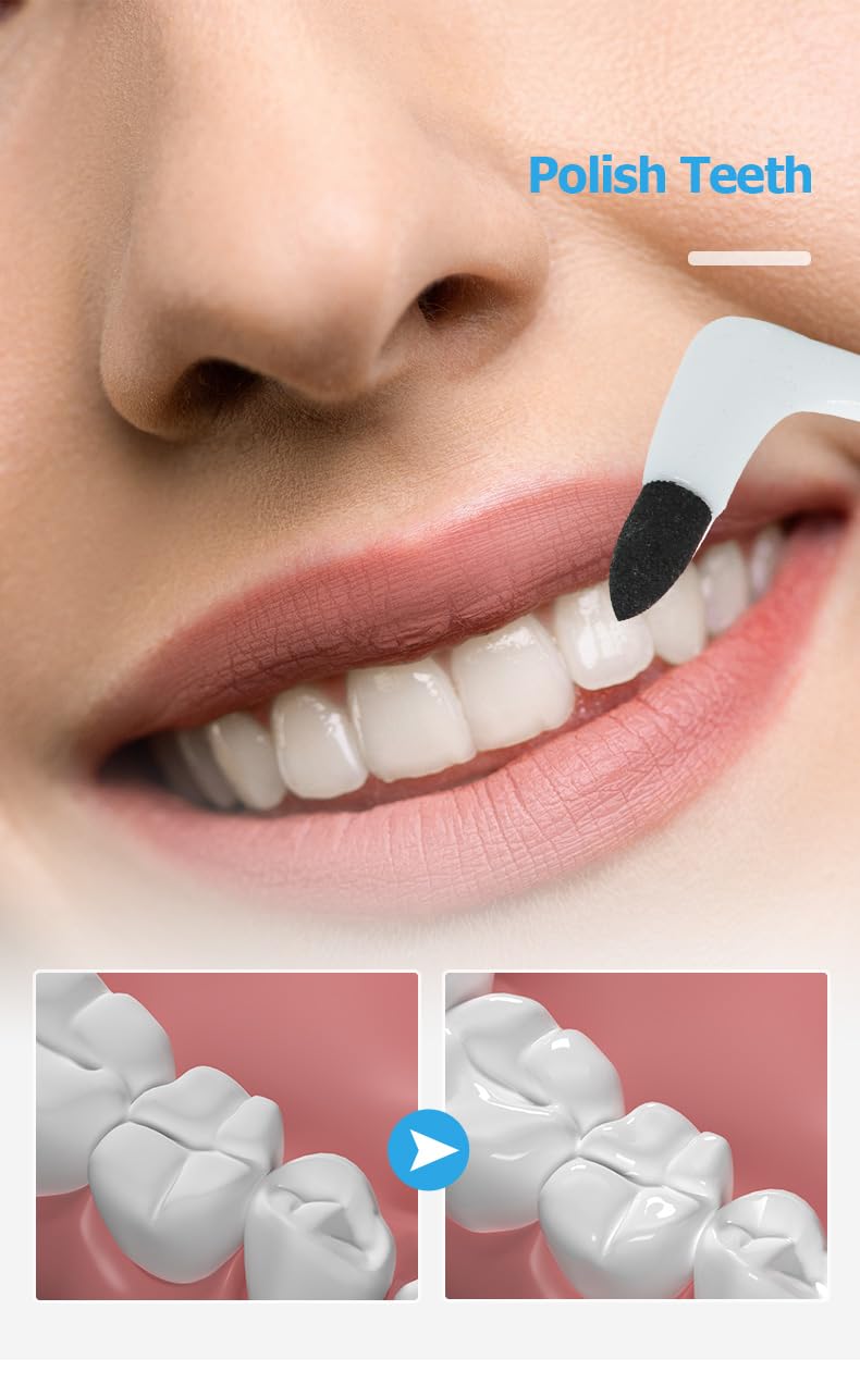 Inralimot Tooth Stain Eraser Tooth Stain Removers Tartar Eraser Polisher Dental Plaque Tool Teeth Cleaning Kit for Teeth Whitening Polishing - Image 4