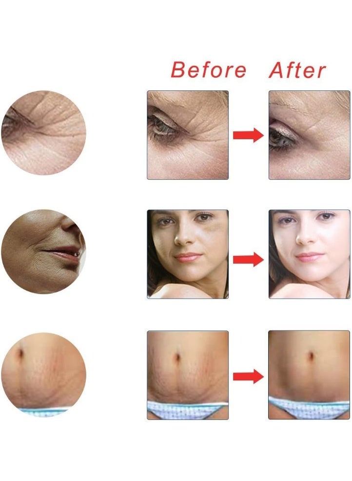 زد جي تي اس رولر ديرما بالإبر الدقيقة والتيتانيوم للعناية بالبشرة للوجه والجسم – يساعد على نمو الشعر ولحية الرجال وتقليل تساقط الشعر (1.5 ملم) - Image 4