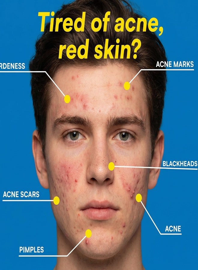 Rhostry Redness Relief Face Balm, Plant-Based Moisturizing Balm for Blemish-Prone Skin, Soothing Care for Sensitive, Oily & Combination Skin, Supports Skin Barrier, Daily Facial Care, 1.05 Oz - Image 2