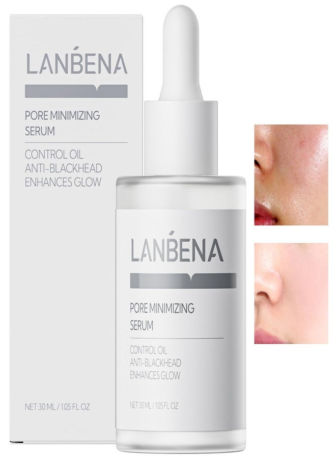 LANBENA Pore Minimizing Serum, 30ml / 1.05 FL. OZ - Image 1