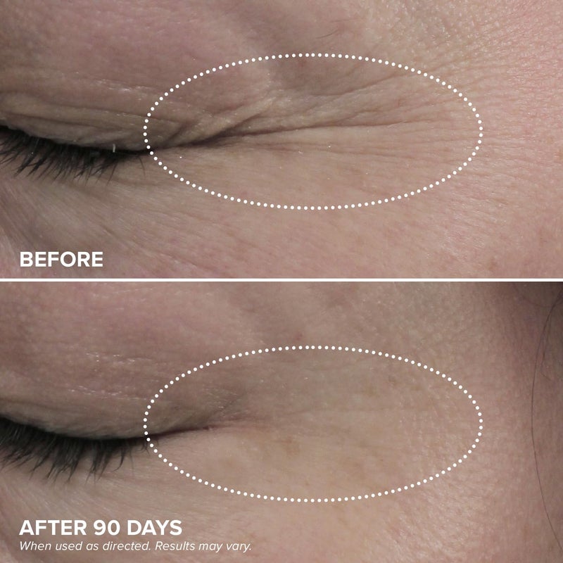 DRMTLGY HPR Eye Cream - Retinoid Under Eye Cream for Under Eyes, 0.5 fl oz - Image 4