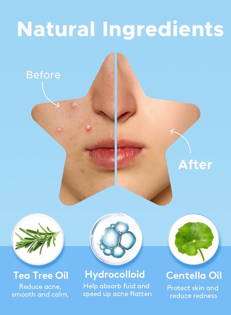 Chillspace 336 Pcs Acne Pimple Patches, Star Hydrocolloid Pimple Patch  for Face with Tea Tree Oil & Centella Oil, Cute Zit Patches Pimple Stickers Acne Dots - Image 3