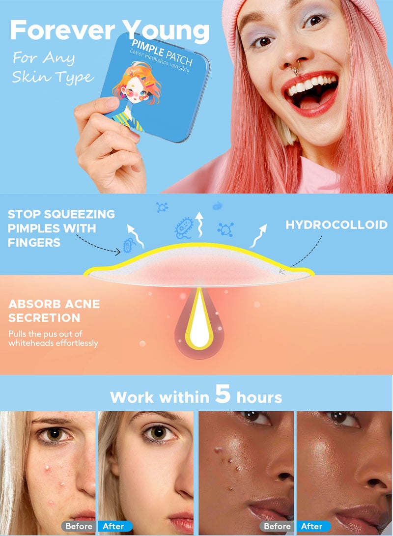 Chillspace 336 Pcs Acne Pimple Patches, Star Hydrocolloid Pimple Patch  for Face with Tea Tree Oil & Centella Oil, Cute Zit Patches Pimple Stickers Acne Dots - Image 4