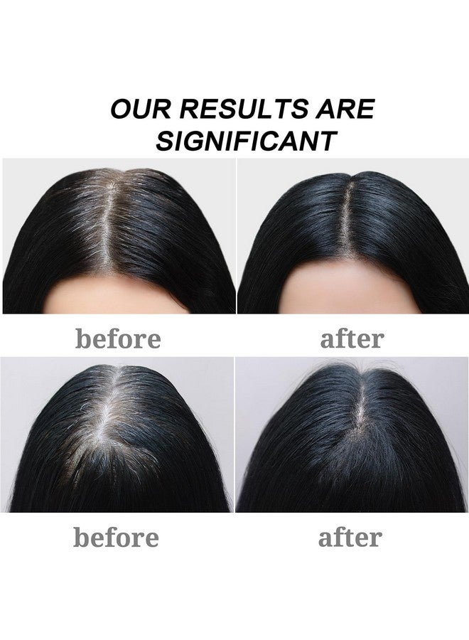 صابون شامبو للشعر الرمادي للجنسين، قطعتان من صابون تغميق الشعر الرمادي لتنظيف فروة الرأس بعمق، صابون شامبو للشعر الرمادي للرجال والنساء - Image 5