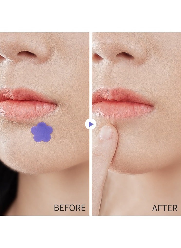 Kormesic حب الشباب رقعة hydrocolloid 20pcs - Image 5