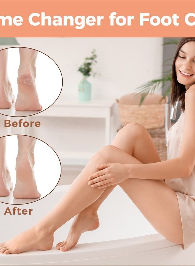 Easkep Foot File Foot Scrubber Pedicure - Callus Remover for Feet Easkep Professional Foot Grater Rasp Foot Scraper Corns Callous Removers Dry Skin Cracked Dead Skin Remover for Dry and Wet Feet (Golden) - Image 5