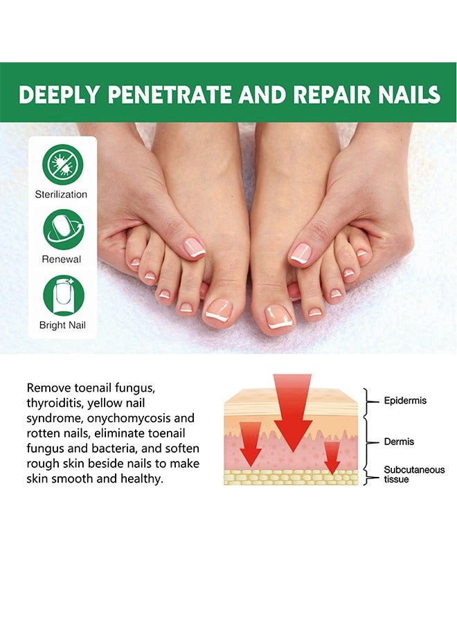 Bupy Nail Repair Patch For Hands And Feet, Soft Ingrown Nails, Thickened Nails, Bright Nails, Nail Grooves, Onychomycosis Care Patch - Image 3