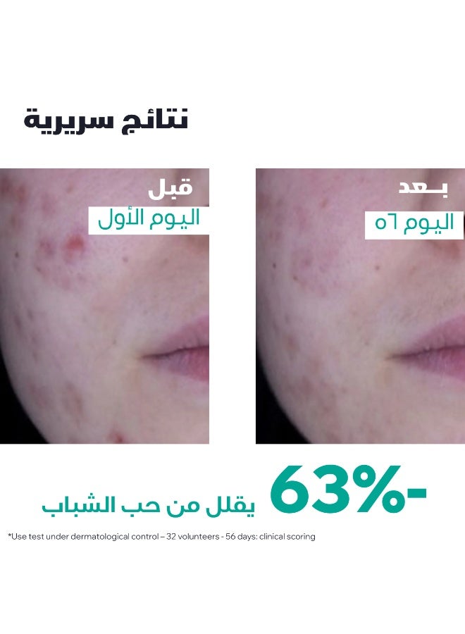 URIAGE HYSEAC 3-Regul+ Global Anti-Blemish Care with 6.8% AHA & Zinc - 40ml - Image 4