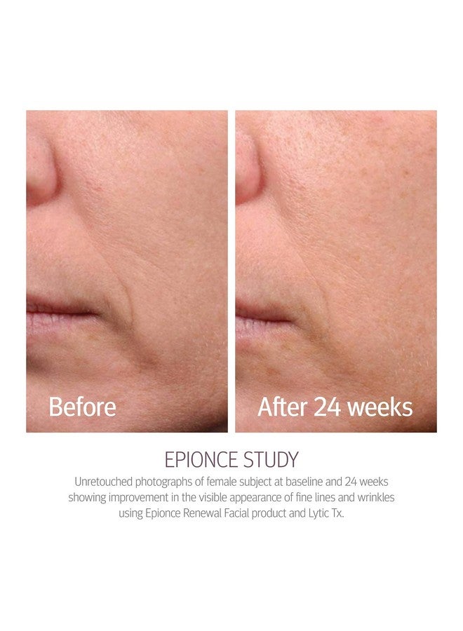 Epionce Renewal Facial Lotion - Hydrating Face Moisturizer, Anti Aging & Dry Skin Barrier Repair Face Lotion, Glycerin Facial Moisturizer Skin Care - Image 3