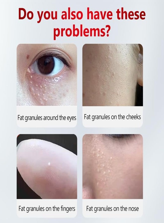 SERYNTH Premium Milia Remover Serum for Eyes & Face — Salicylic Acid Treatment for Stubborn Milia, Fat Granules & Bumps — Gentle Non-Irritating Spot Treatment Serum — Lightweight, All Skin Types (30ml) - Image 4