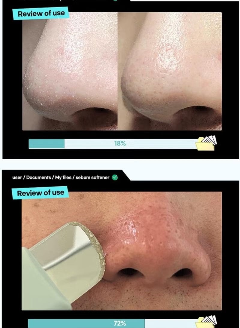 ilso Super Melting Sebum Softener, Pore Cleansing Solution, Melts Away Blackheads & Sebum, Korean Skincare - Image 5