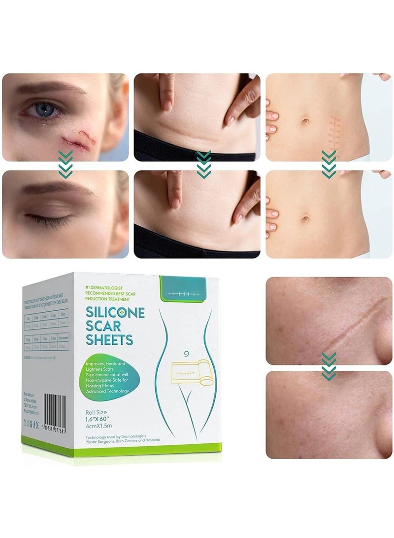 Scar Sheets(1.6'' x 60''Roll-1.5M) - Soft Silicone Gel Scar Tape Painless Silicone Tape Roll - Effective Silicone Scar Removal Strips Sheets for C-Section & Keloid Surgery, Burn, Acne - Image 3
