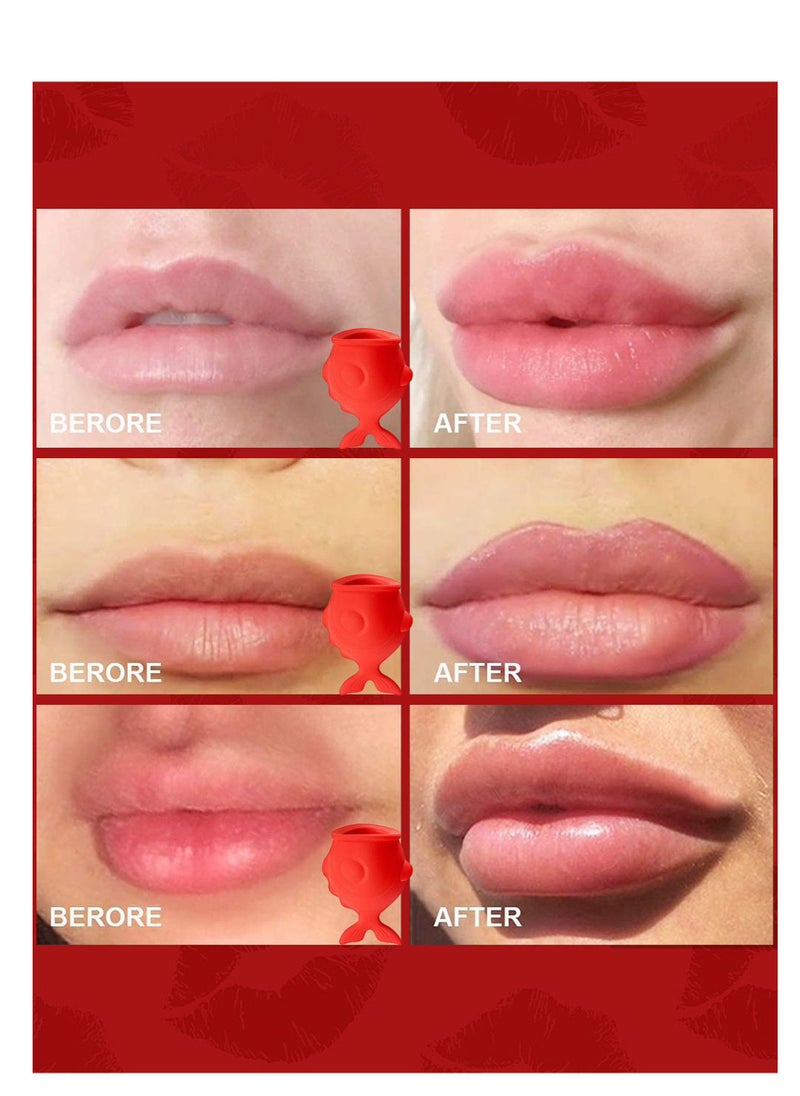 Handaiyan Lip Plumper Device Enhancer Fish-Shaped Lip Plumper Enhancer Full Lips Enhancement Improving Drooping Lips Enlargement Tools Trainer For Makeup Women Girls  - Image 5