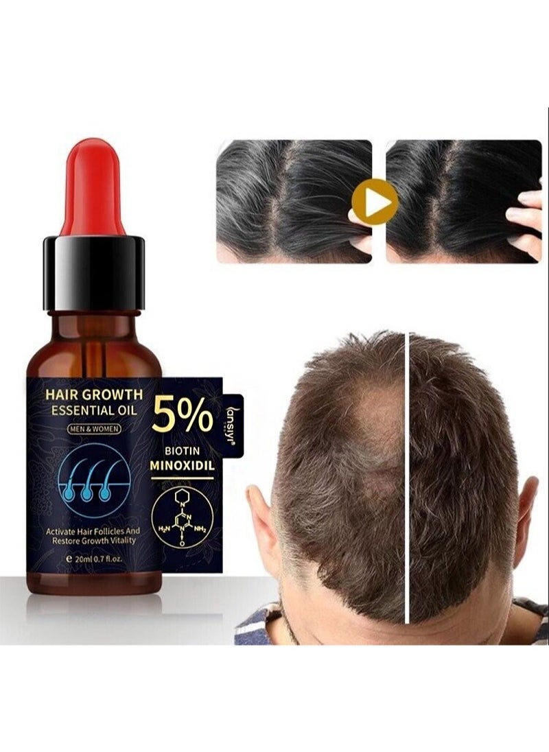 lansiyi - Hair Growth Essenyial Oil - Biotin Hair Growth Serum and 5% Minoxidil Treatment for Stronger, Fuller, Longer Hair - Natural Hair Thickening Treatment - Stops Hair Loss and Thinning for Men and Women - Image 1