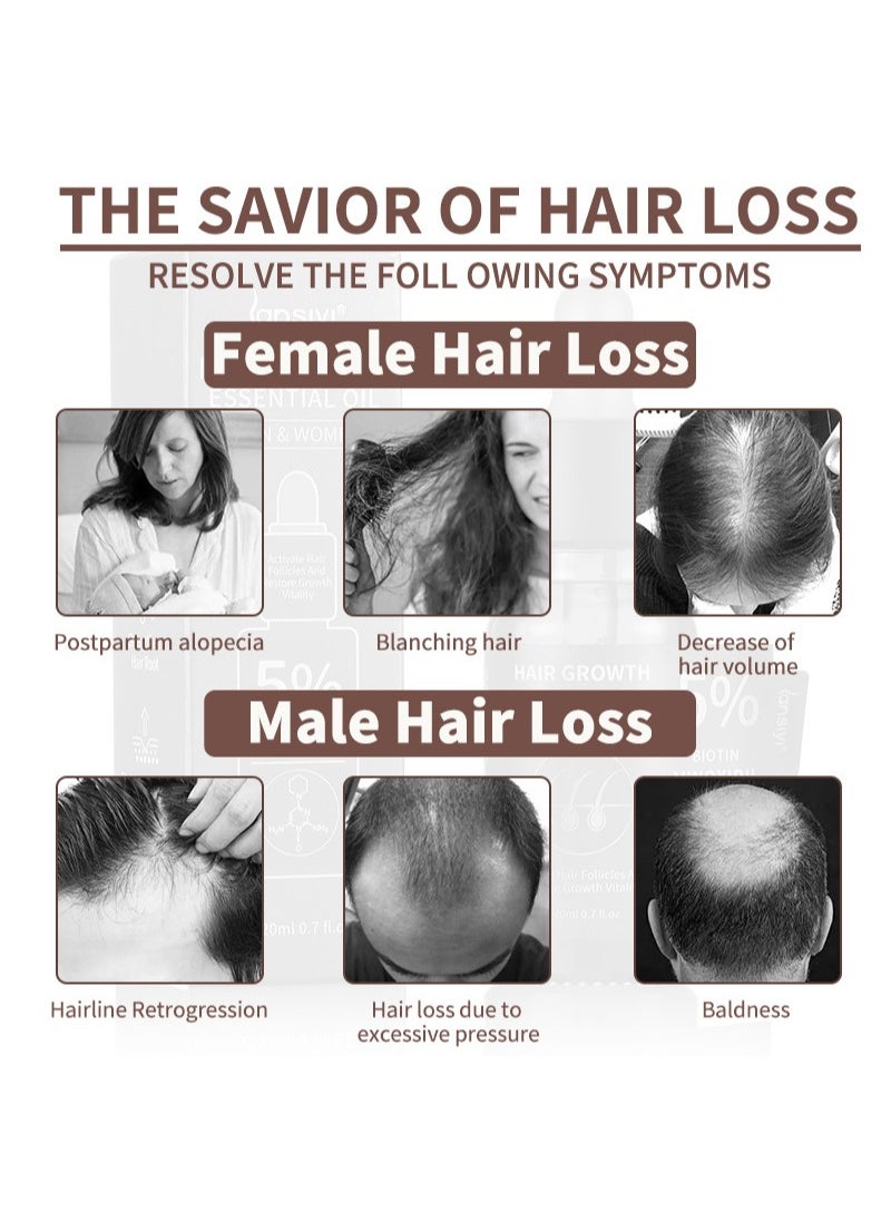 lansiyi - Hair Growth Essenyial Oil - Biotin Hair Growth Serum and 5% Minoxidil Treatment for Stronger, Fuller, Longer Hair - Natural Hair Thickening Treatment - Stops Hair Loss and Thinning for Men and Women - Image 1
