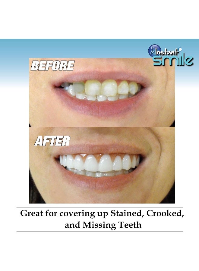 Instant Smile Comfort Fit Flex Bright Shade Upper Veneer Cosmetic Teeth - Image 4