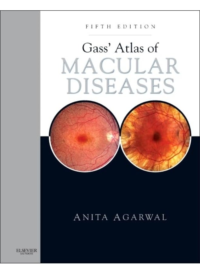 Gass' Atlas of Macular Diseases: 2-Volume Set - Expert Consult: Online and Print 