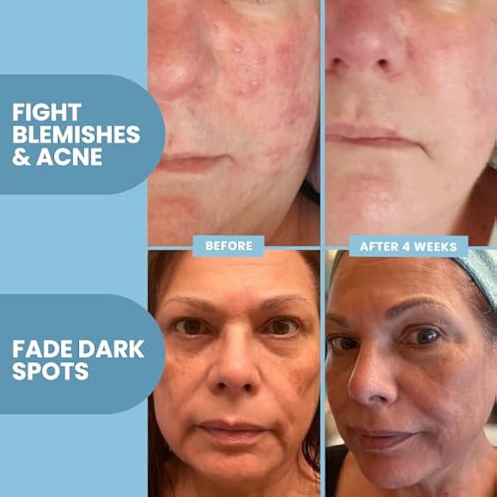 Eva Naturals Vitamin C Serum for Face - 20% Vit C with Hyaluronic Acid, Ferulic Acid & Vitamin E - Facial Serum for Dark Spots, Acne, Anti Aging, Glow & Even Skin Tone, 2 Fl Oz - Image 4