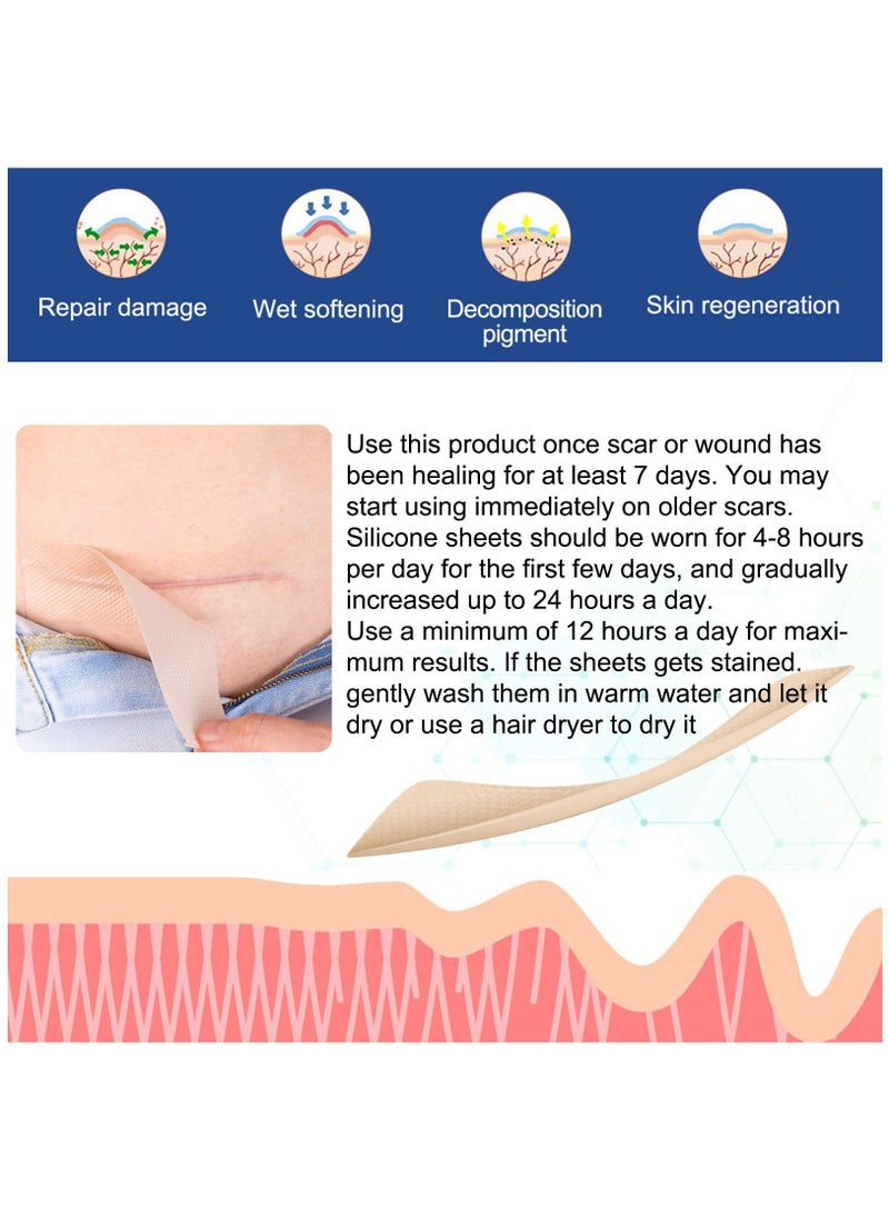 ALIVER - Medical Grade Silicone Scar Sheets Roll 3m Tape Keloid C-Section Surgical Scars Removal Treatment Silicon Gel Cream Patch Bandage Removes Abs Tuck Surgery Scars (4cm x 3m) - Image 1