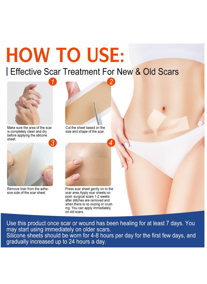 ALIVER - Medical Grade Silicone Scar Sheets Roll 3m Tape Keloid C-Section Surgical Scars Removal Treatment Silicon Gel Cream Patch Bandage Removes Abs Tuck Surgery Scars (4cm x 3m) - Image 1