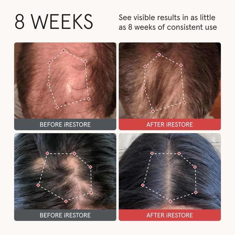 iRESTORE Biotin Hair Conditioner for Damaged Dry Hair - Biotin Conditioner for Fine Hair Growth, Volumizing Thickening Conditioner with Ginseng & Argan Oil to Moisturize, Pair With Hair Loss Shampoo - Image 2