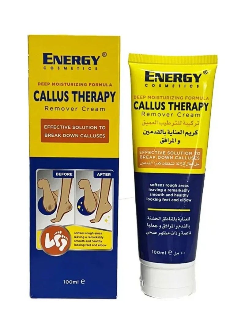إينرجي كريم القدم، لإزالة تشققات كعب القدمين - 100 مل