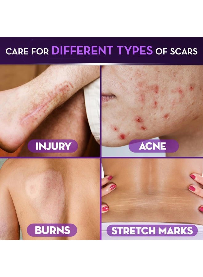 CICATRICURE Advanced Scar Gel for Face & Body - Proven Results in 2 Weeks, Scar Treatment for Surgical Scars, Stretch Marks, Scars of Burns and Injuries, Acne Scar Treatment, 1 oz (28 g) - Pack of 2 - Image 4