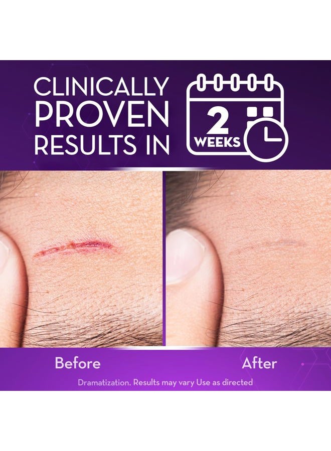CICATRICURE Advanced Scar Gel for Face & Body - Proven Results in 2 Weeks, Scar Treatment for Surgical Scars, Stretch Marks, Scars of Burns and Injuries, Acne Scar Treatment, 1 oz (28 g) - Pack of 2 - Image 3