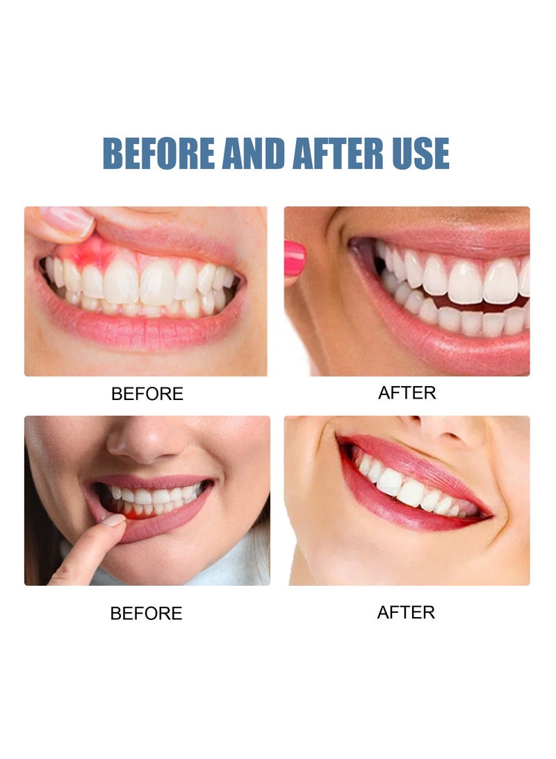 EELHOE Gum Repair Spray relieves swollen and sore gums, whitens teeth, and provides excellent oral health care. Repair gum tissue, effectively prevent toothache, and maintain a healthy oral environment. - Image 3