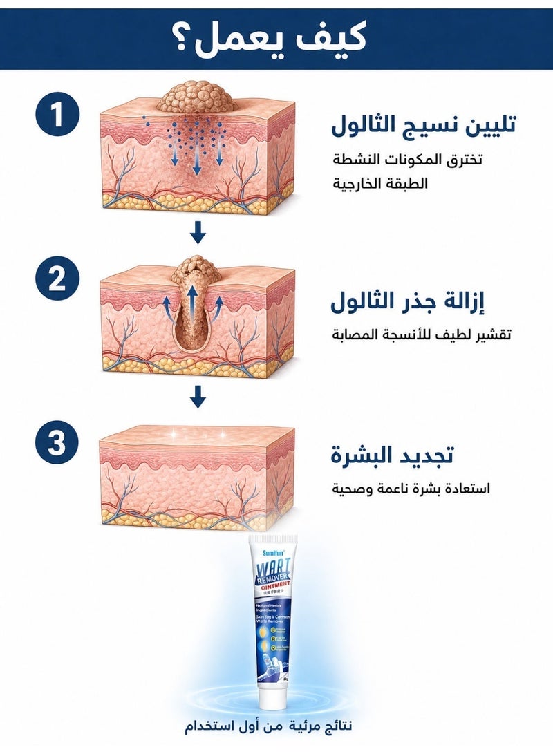 كريم إزالة الثآليل والشامات بالخلاصات العشبية الطبيعية، مرهم علاجي للثآليل والشامات بالبشرة بمكونات طبيعية، مناسب لعلاج الثآليل والشامات وآفات القدم - Image 5