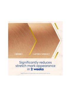 Nivea NIVEA LUMINOUS630 Stretch Marks Reduction Body Oil-Serum  - Image 3