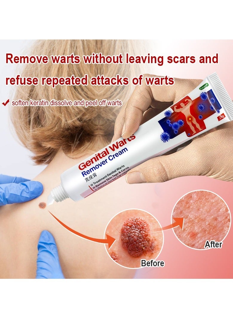 KanyeHB 2-PACK Wart Removal Cream,  Wart Remover for Genital Warts, Plantar Warts, Common Warts, Corns, Wart Cream 20g*2 - Image 2