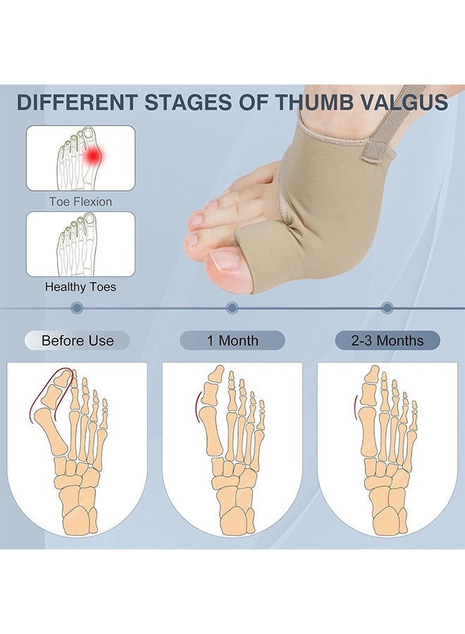 اتش واي 1 زوج مصحح الورم للنساء والرجال ، مصحح أصابع القدم جوارب الورم مريح ومسامي للدعم النهاري / الليلي ، مكواة فرد أصابع القدم الكبيرة لتخفيف الآلام من إبهام القدم (بيج ، متوسط) - Image 3
