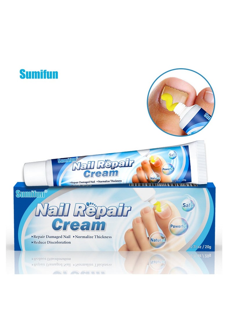 سوميفون كريم 20 جرام لأصابع القدم، كريم إصلاح الأظافر، كريم الأظافر المضاد للمواد الضارة لإصلاح أصابع القدم للعناية بالأظافر مثالي للرجال والنساء للاستخدام المنزلي - Image 1