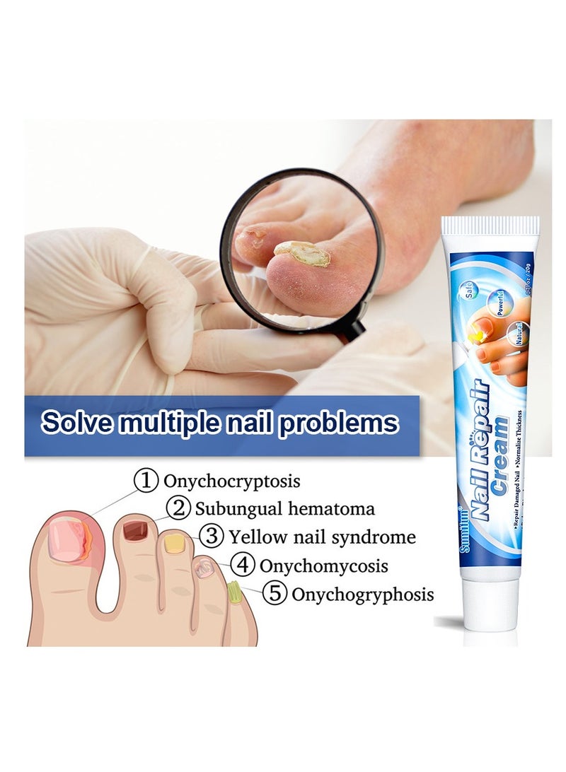 سوميفون كريم 20 جرام لأصابع القدم، كريم إصلاح الأظافر، كريم الأظافر المضاد للمواد الضارة لإصلاح أصابع القدم للعناية بالأظافر مثالي للرجال والنساء للاستخدام المنزلي - Image 2