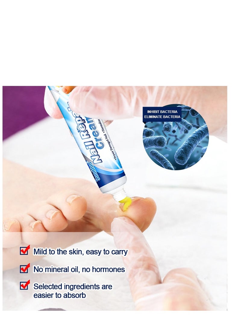 سوميفون كريم 20 جرام لأصابع القدم، كريم إصلاح الأظافر، كريم الأظافر المضاد للمواد الضارة لإصلاح أصابع القدم للعناية بالأظافر مثالي للرجال والنساء للاستخدام المنزلي - Image 3