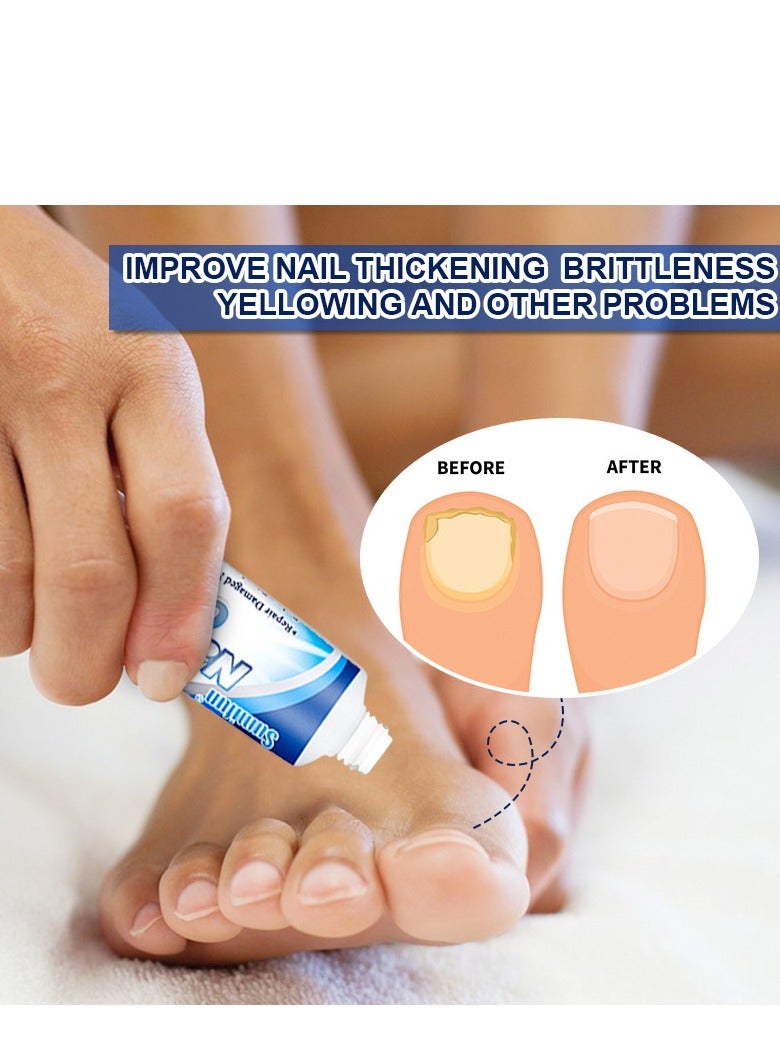 سوميفون كريم 20 جرام لأصابع القدم، كريم إصلاح الأظافر، كريم الأظافر المضاد للمواد الضارة لإصلاح أصابع القدم للعناية بالأظافر مثالي للرجال والنساء للاستخدام المنزلي - Image 5
