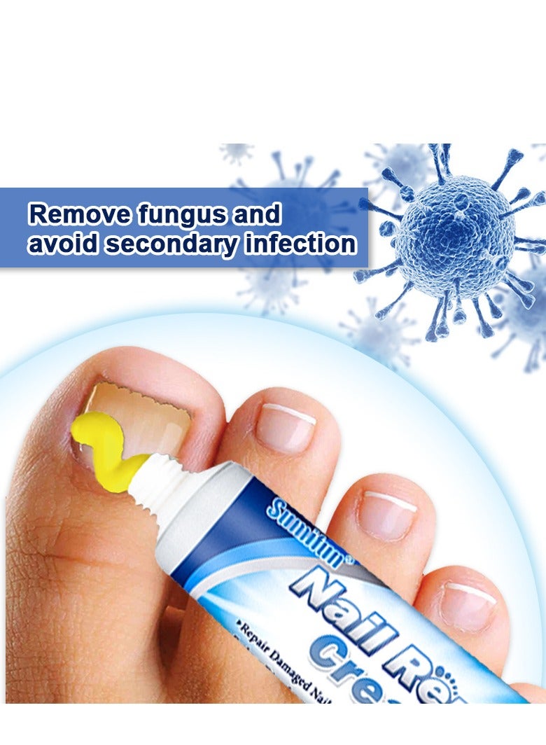 سوميفون كريم 20 جرام لأصابع القدم، كريم إصلاح الأظافر، كريم الأظافر المضاد للمواد الضارة لإصلاح أصابع القدم للعناية بالأظافر مثالي للرجال والنساء للاستخدام المنزلي - Image 4