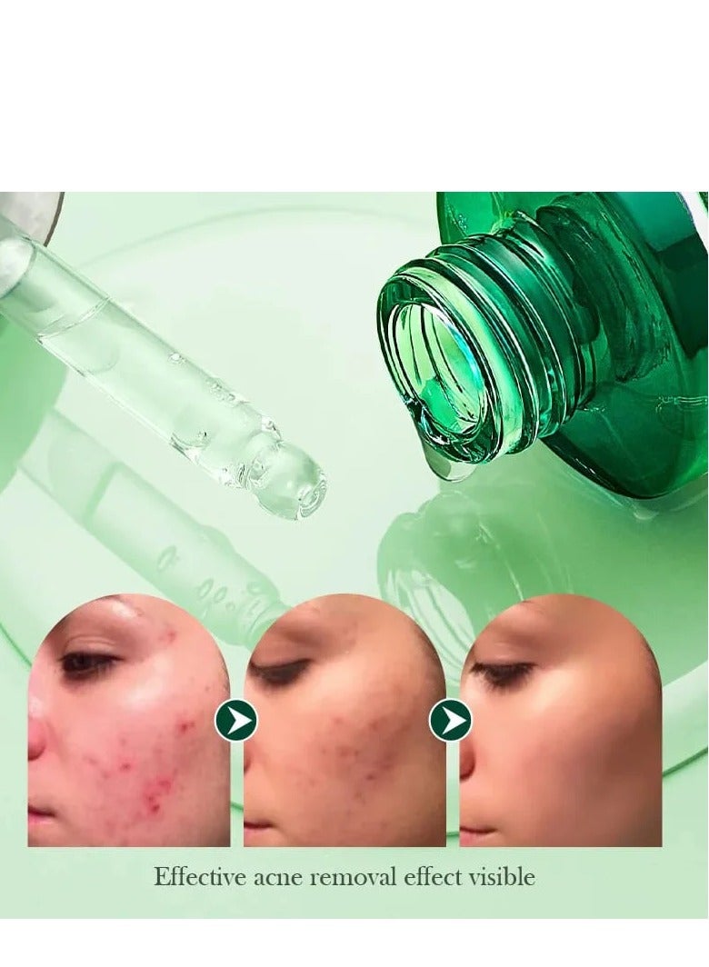 SADOER Sadoer Tea Tree Acnes Oil Control Face Serum  - Image 3