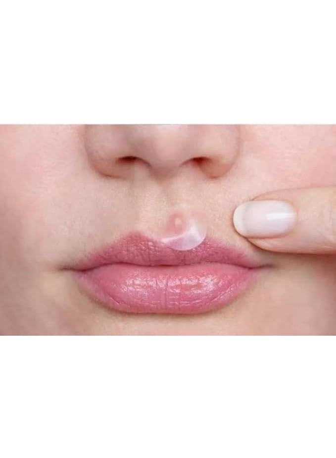 كيور إيد ملصقات هيدروكولويد لعلاج حب الشباب وقروح البرد، ملصقات حبوب لون البشرة 24 قطعة - Image 4