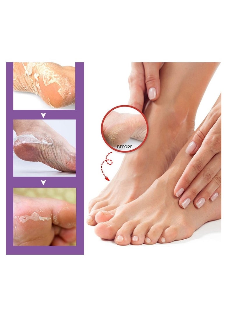 efero 2 Pairs Strawberry Foot Mask For Dry Cracked Feet,Remove Dead Skin Niacinamide Moisturizing Foot Mask Moisturizing Repairing Nourishing Exfoliating Smooth Skin Care Dry Cracked Feet,Remove Dead Skin - Image 2