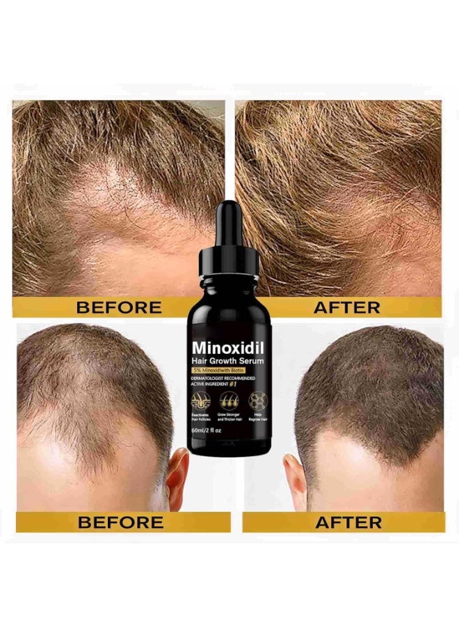 EELHOE 5% Minoxidil Serum for Men Women,60ml Minoxidil for Women Men HairGrowth Minoxidil for Men Beard Growth Serum,Promotes hair Growth,Helps Prevent hair Fall and Loss (2pcs 60ml) - Image 4