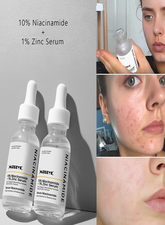 MIZEEYE Niacinamide 10% + Zinc 1% Face Serum for Women, 2 PCS Refreshing Niacinamide Facial Serum For Acne. - Image 3