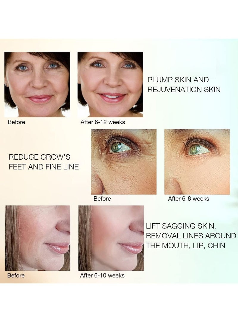 Excefore - RF Radio Frequency Facial Machine, Home Use RF Skin Tightening Device for Skin Rejuvenation, for All Body, Face, Neck, Arm, Waist, Thigh, Buttock, Anti-Aging, Reduce Wrinkles - Image 1