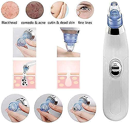WOLTAX Beautiful Skin Care Expert Acne Pore Cleaner Vacuum Blackhead Remover Kit Pimple Acne Removal Tool Blackhead Remover Tool Multicolour Silicone Head 1 Count - Image 5