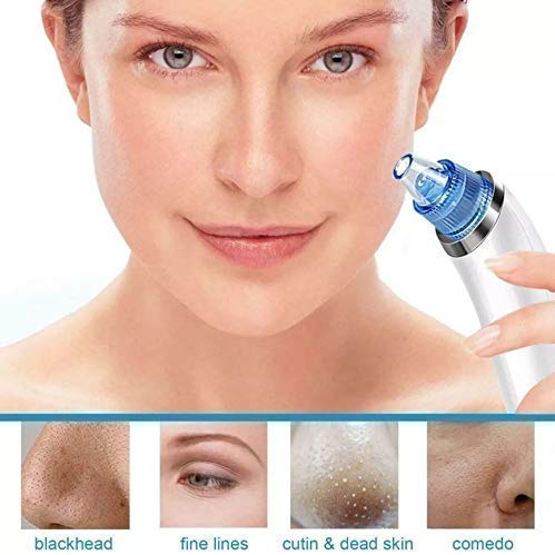 WOLTAX Beautiful Skin Care Expert Acne Pore Cleaner Vacuum Blackhead Remover Kit Pimple Acne Removal Tool Blackhead Remover Tool Multicolour Silicone Head 1 Count - Image 3
