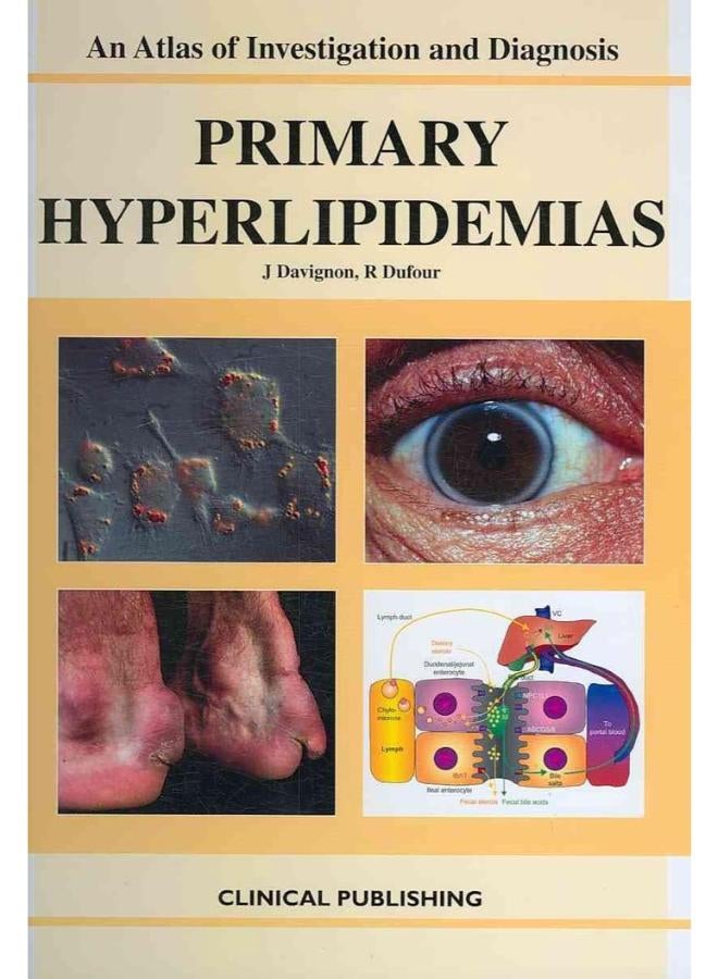 فرط شحميات الدم الأولية